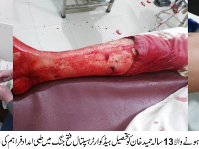 فتح جنگ، دوران کھیل جھگڑا، فائرنگ سے نوجوان زخمی