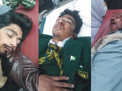 موٹرسائیکل حادثہ میں زخمی ہونے والے بھائی اور جاں بحق ہونیوالے شخص 